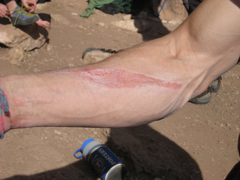 Rope burn that occurred during "an unscheduled equipment / system check"