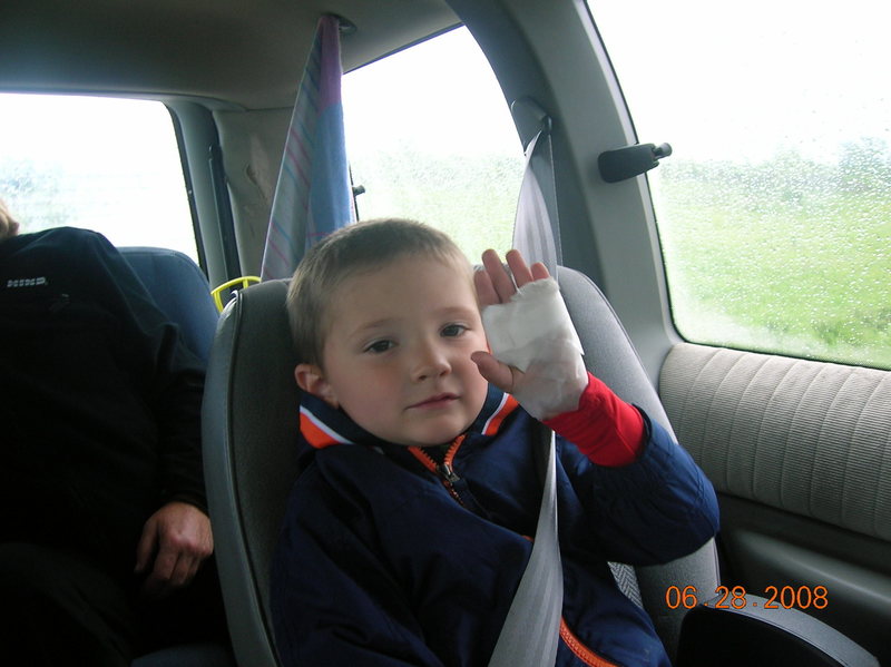 Aiden after a hard day of climbing at Red Wing shows off his bandaged hand