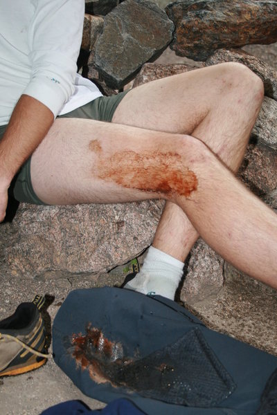 mikes leg at the end of the day.  the infamous north chimney incident. mike thought it would be cool to reenact what charlie fowler did. looks like blood.  Ha!  just a smooshed GU packet. mmm ,it does go well with the chicken.  right again peter.