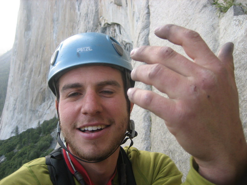 Matt P after taking a 30 footer trying to do the 7th pitch clean.  He back-flopped off of the black dagger half way through the fall and broke his finger.  