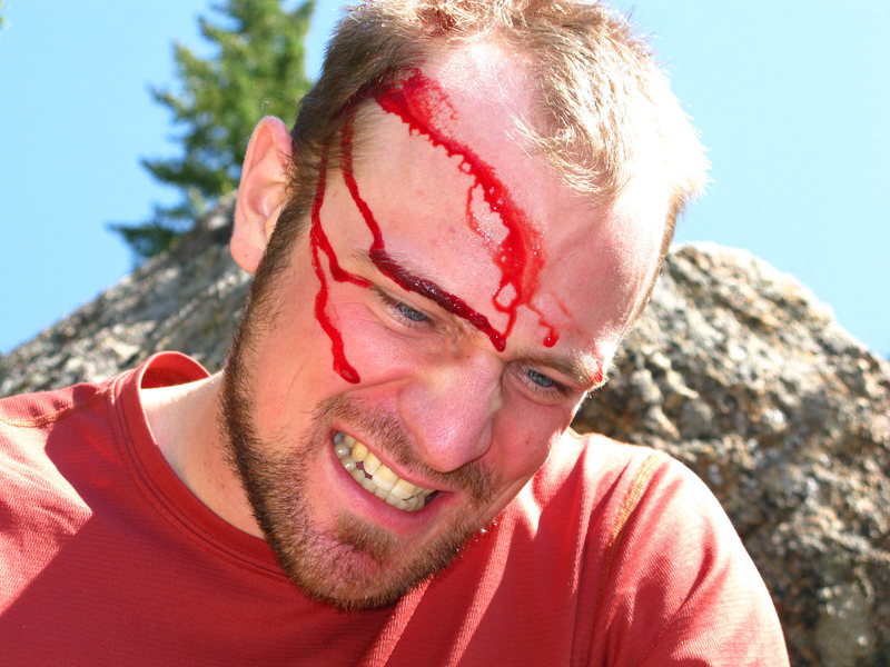 I was reminded by a fallen dead tree that most climbing accidents occur on the descent.