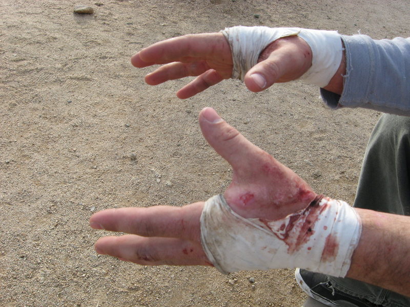 Mangled Hands after two weekends of the wide. This route sealed their fate.<br>
Photo by beny.