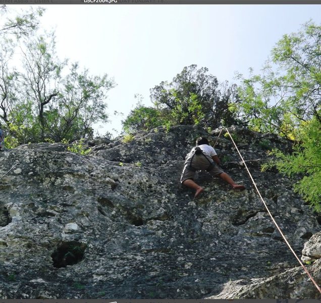 climber on same-day surgery  5.8