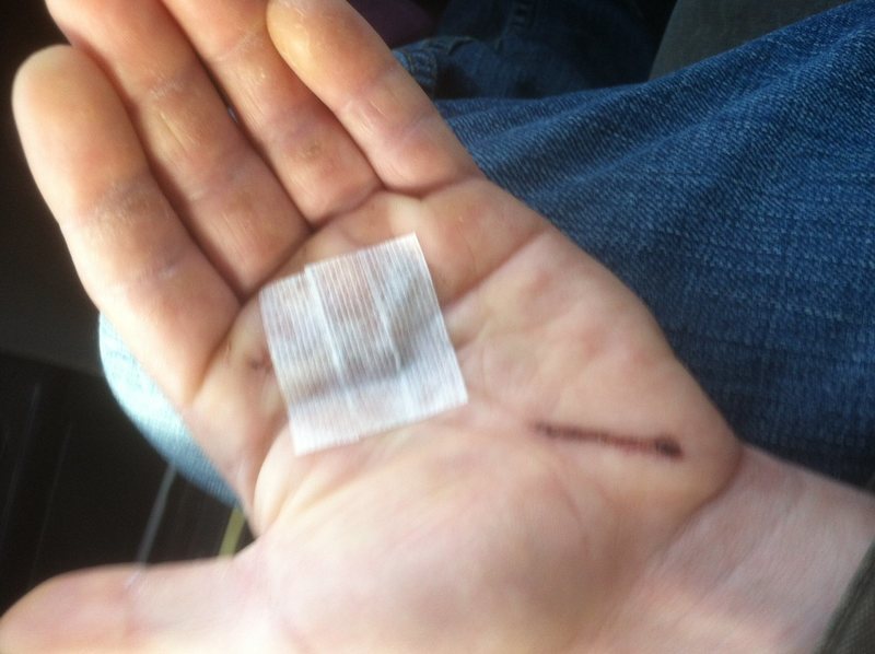 stitches out, and hand taped together