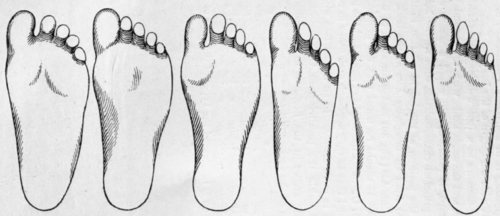 foot shape