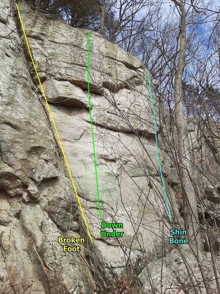 Broken Foot, Down Under, Shin Bone.